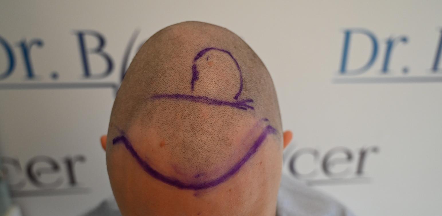 /foren/transplant/index.php/fa/60409/0/