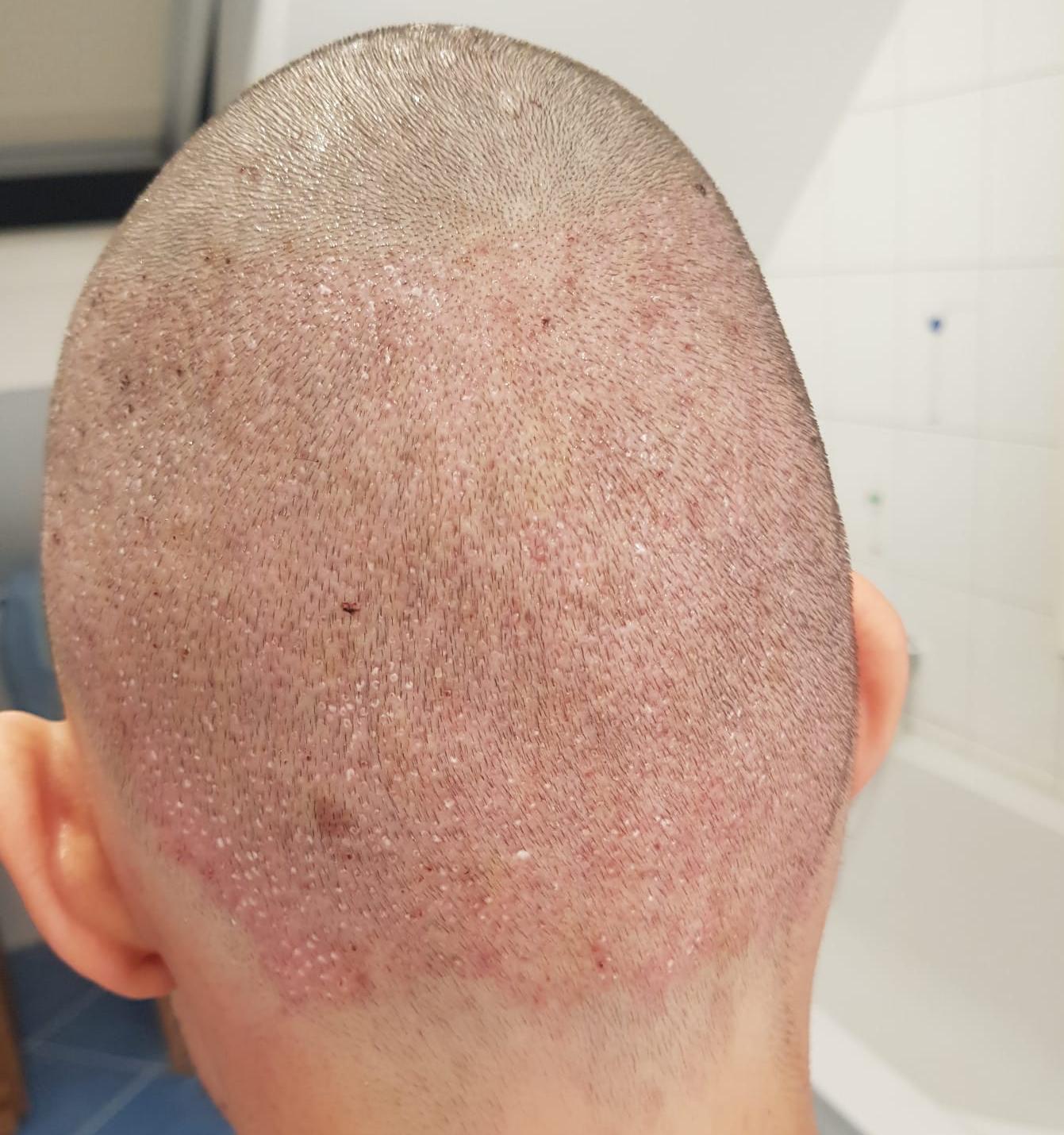 /foren/transplant/index.php/fa/60411/0/