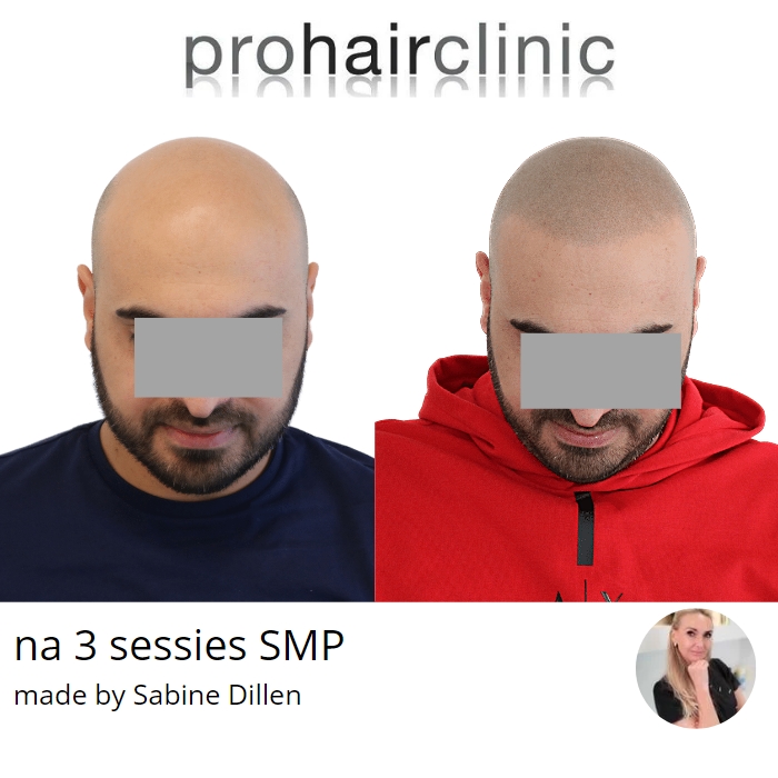 /foren/transplant/index.php/fa/60468/0/