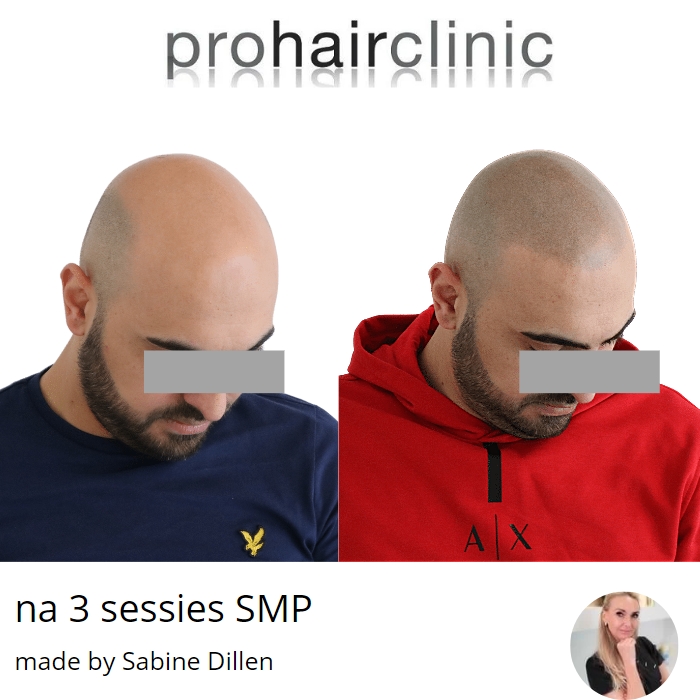 /foren/transplant/index.php/fa/60469/0/