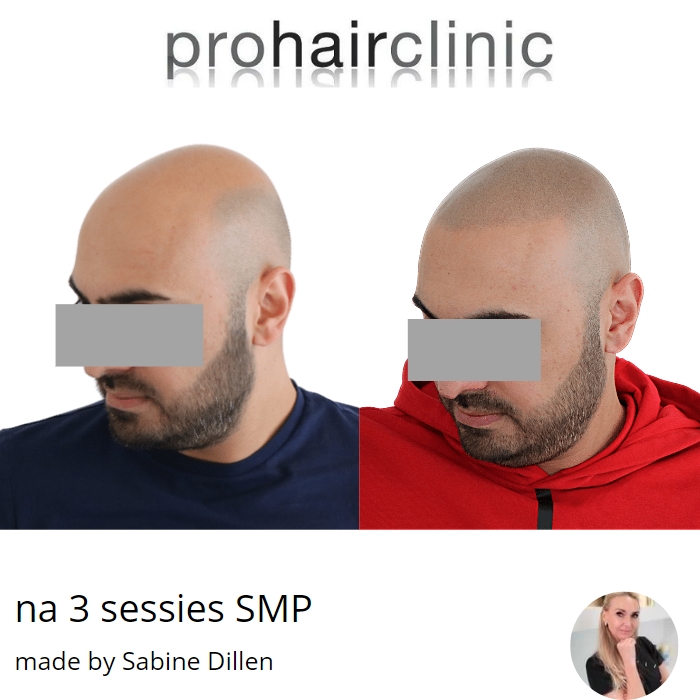 /foren/transplant/index.php/fa/60470/0/