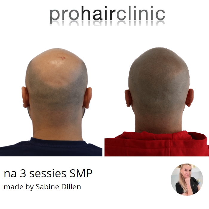 /foren/transplant/index.php/fa/60471/0/