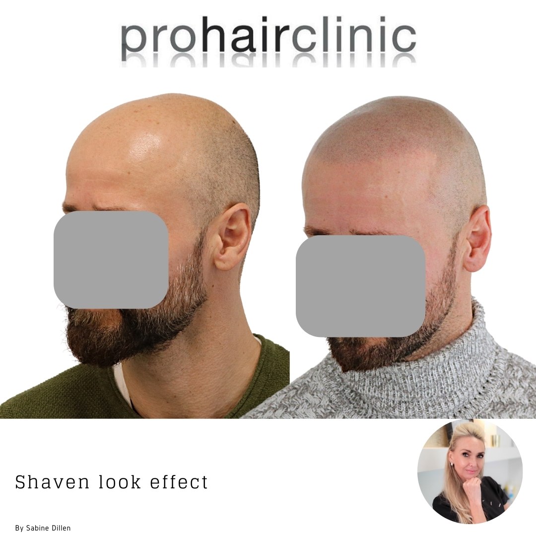 /foren/transplant/index.php/fa/60476/0/