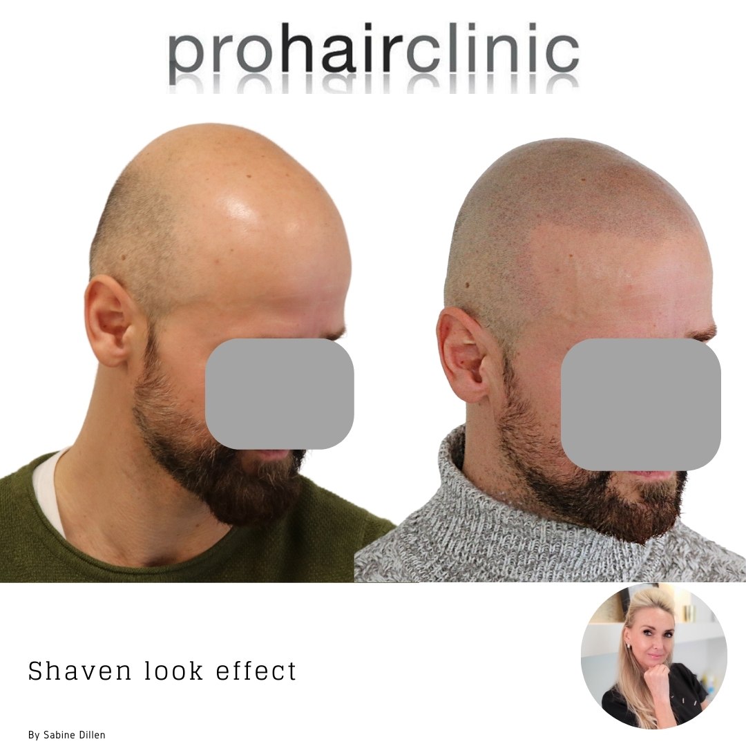 /foren/transplant/index.php/fa/60477/0/