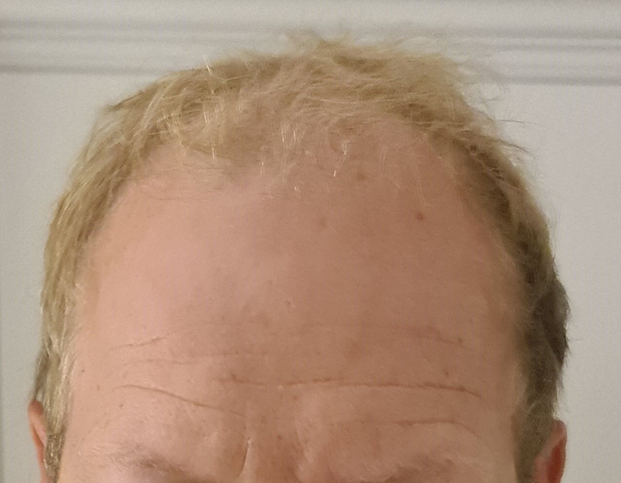 /foren/transplant/index.php/fa/60485/0/