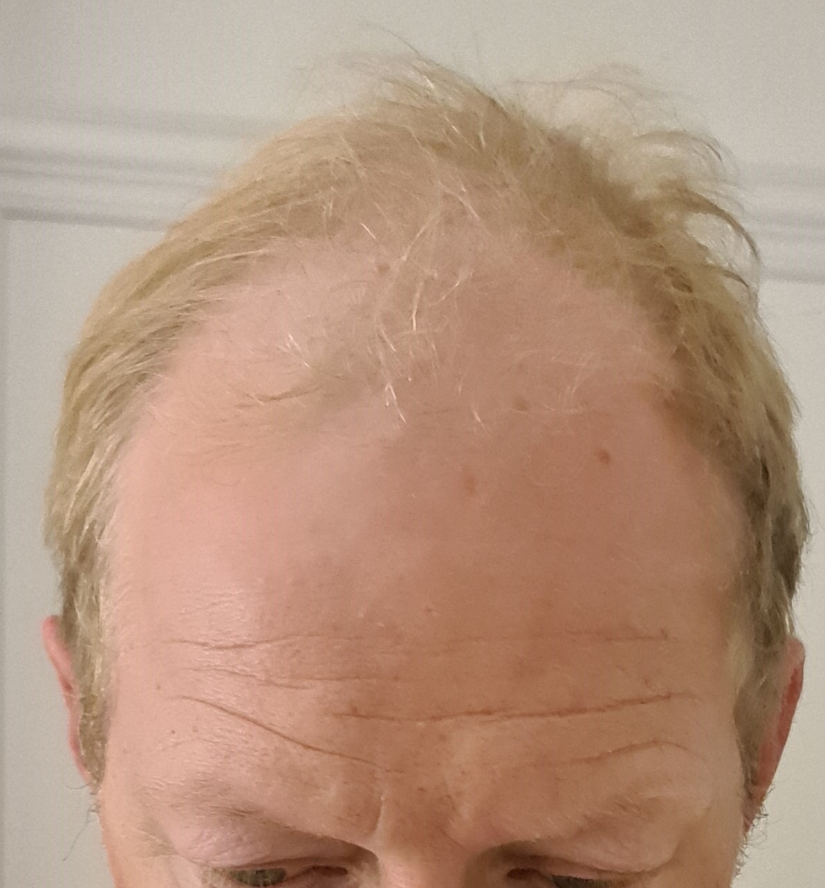 /foren/transplant/index.php/fa/60486/0/