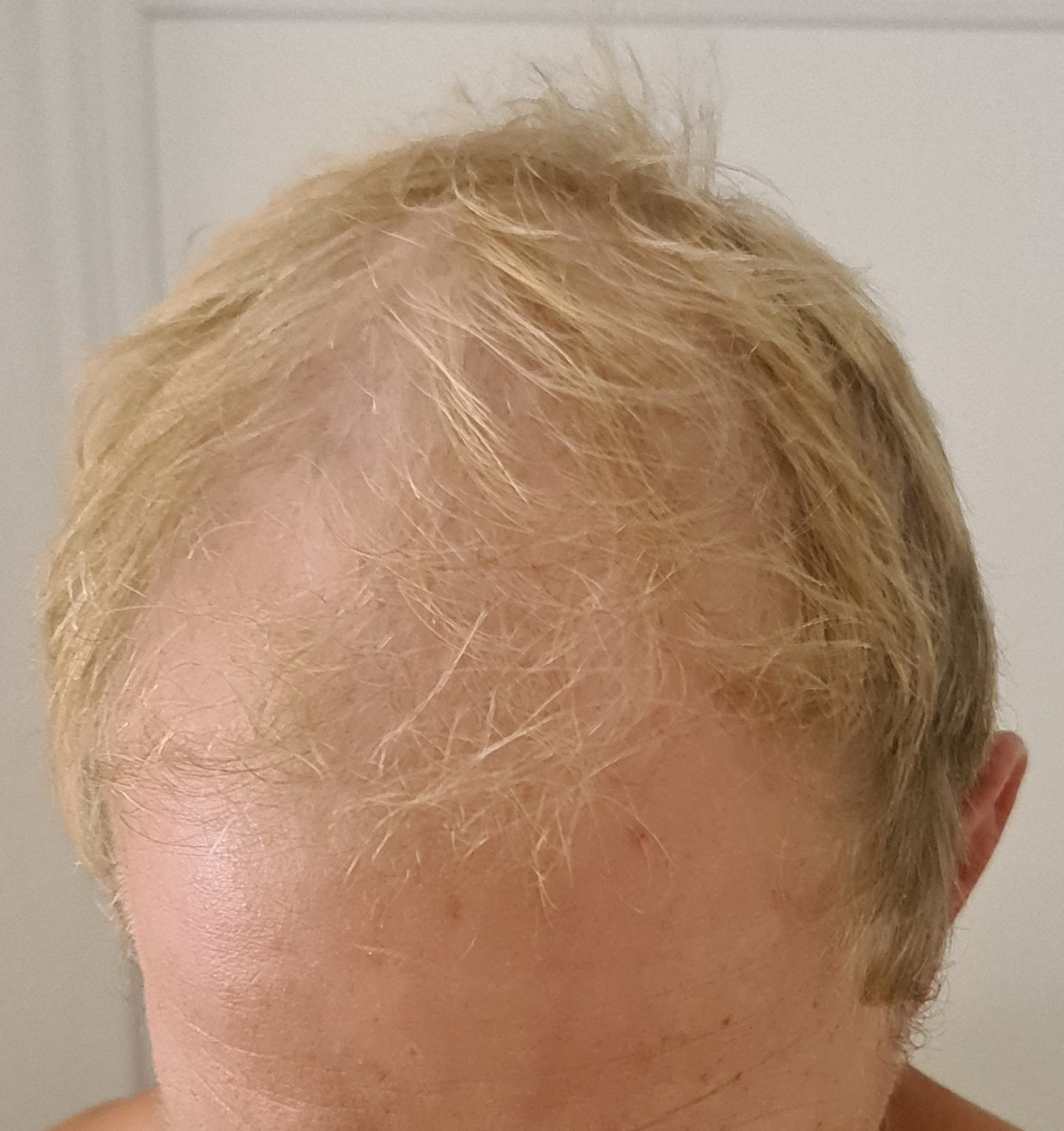 /foren/transplant/index.php/fa/60487/0/