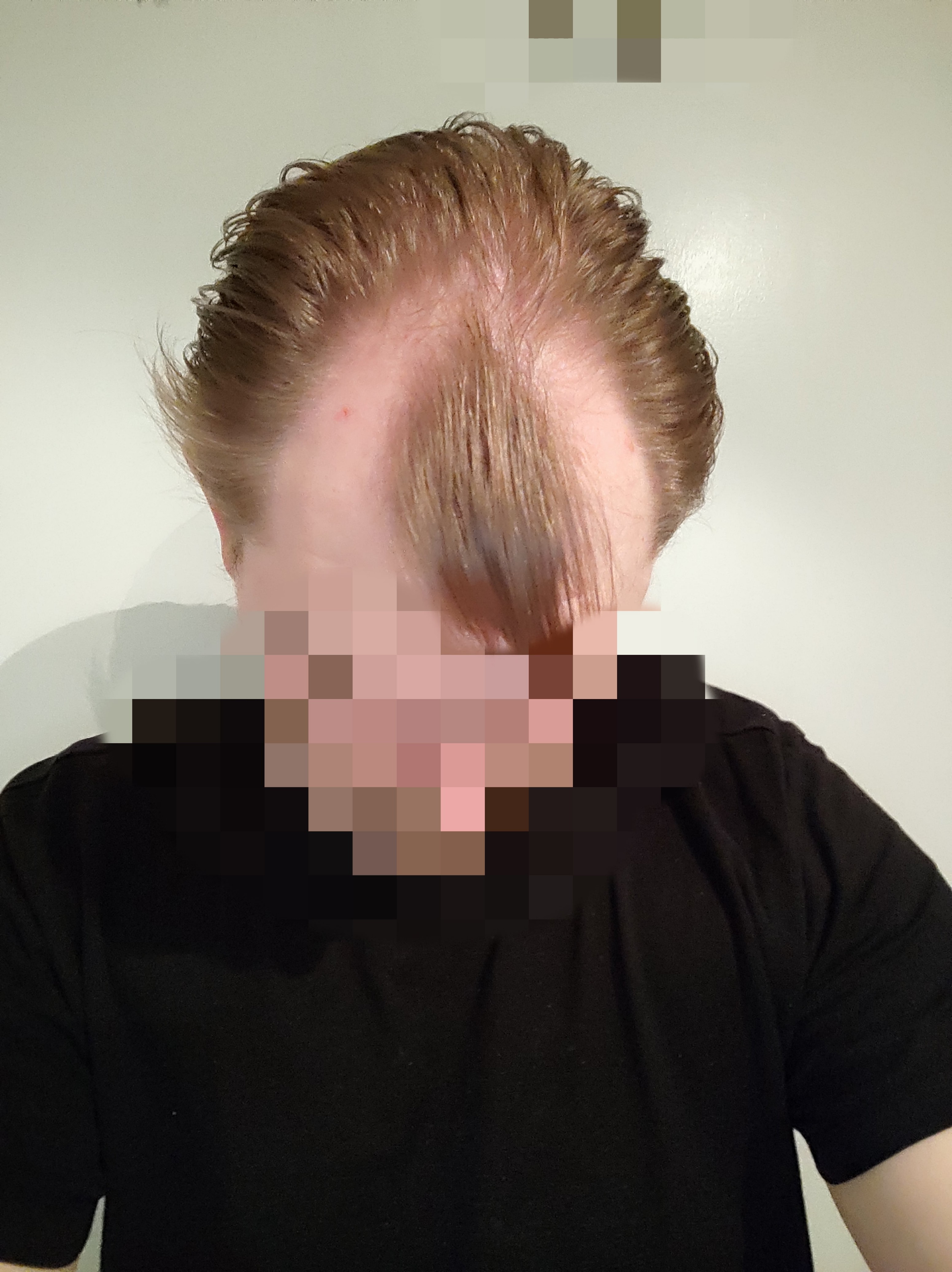 /foren/transplant/index.php/fa/60581/0/