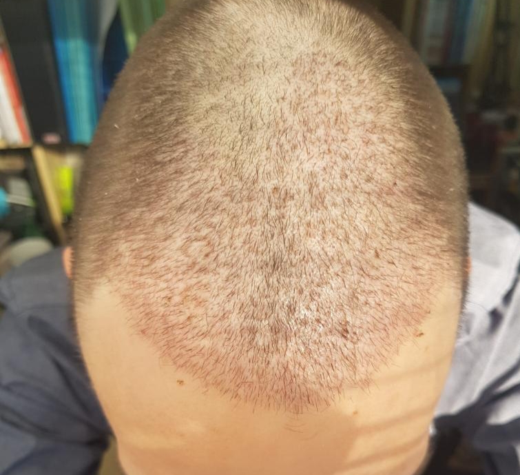 /foren/transplant/index.php/fa/60616/0/