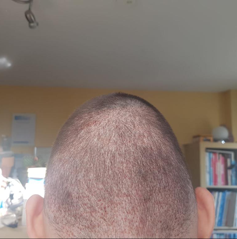 /foren/transplant/index.php/fa/60617/0/