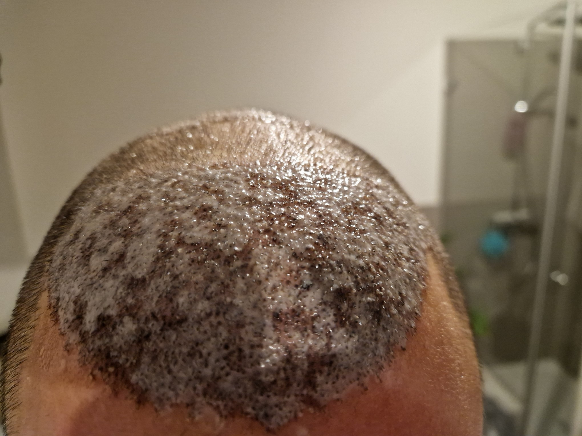 /foren/transplant/index.php/fa/60629/0/