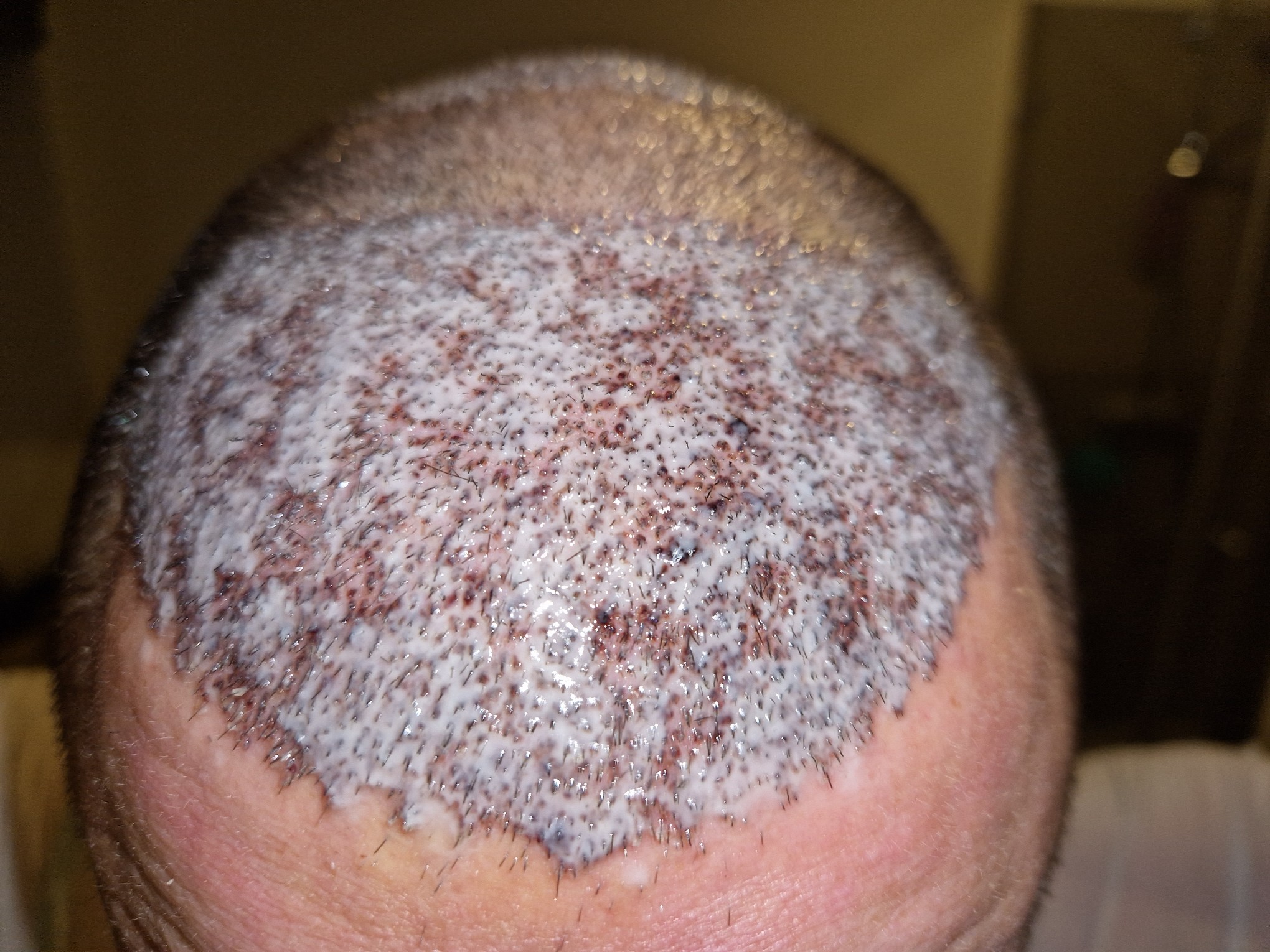 /foren/transplant/index.php/fa/60630/0/