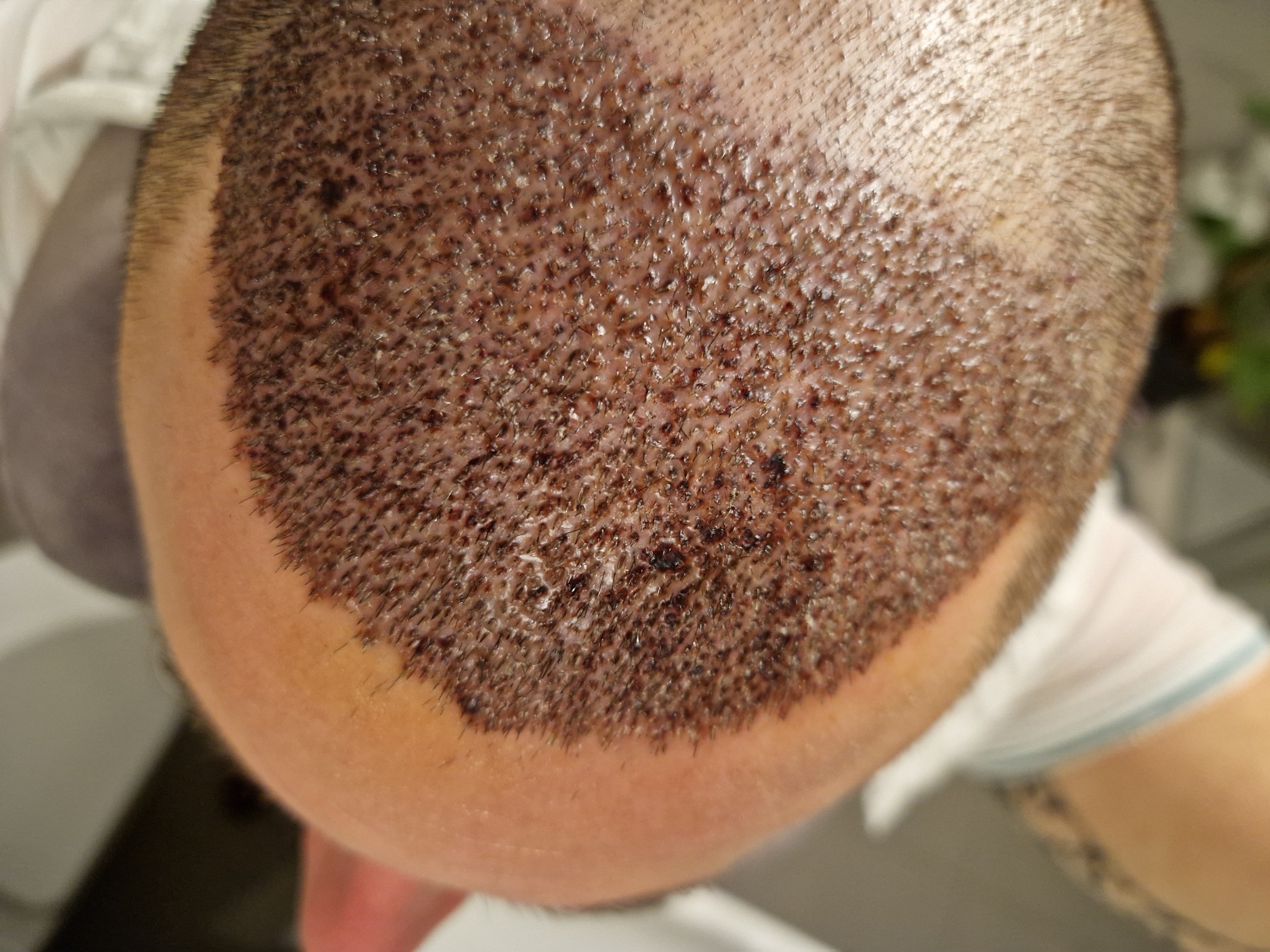 /foren/transplant/index.php/fa/60631/0/