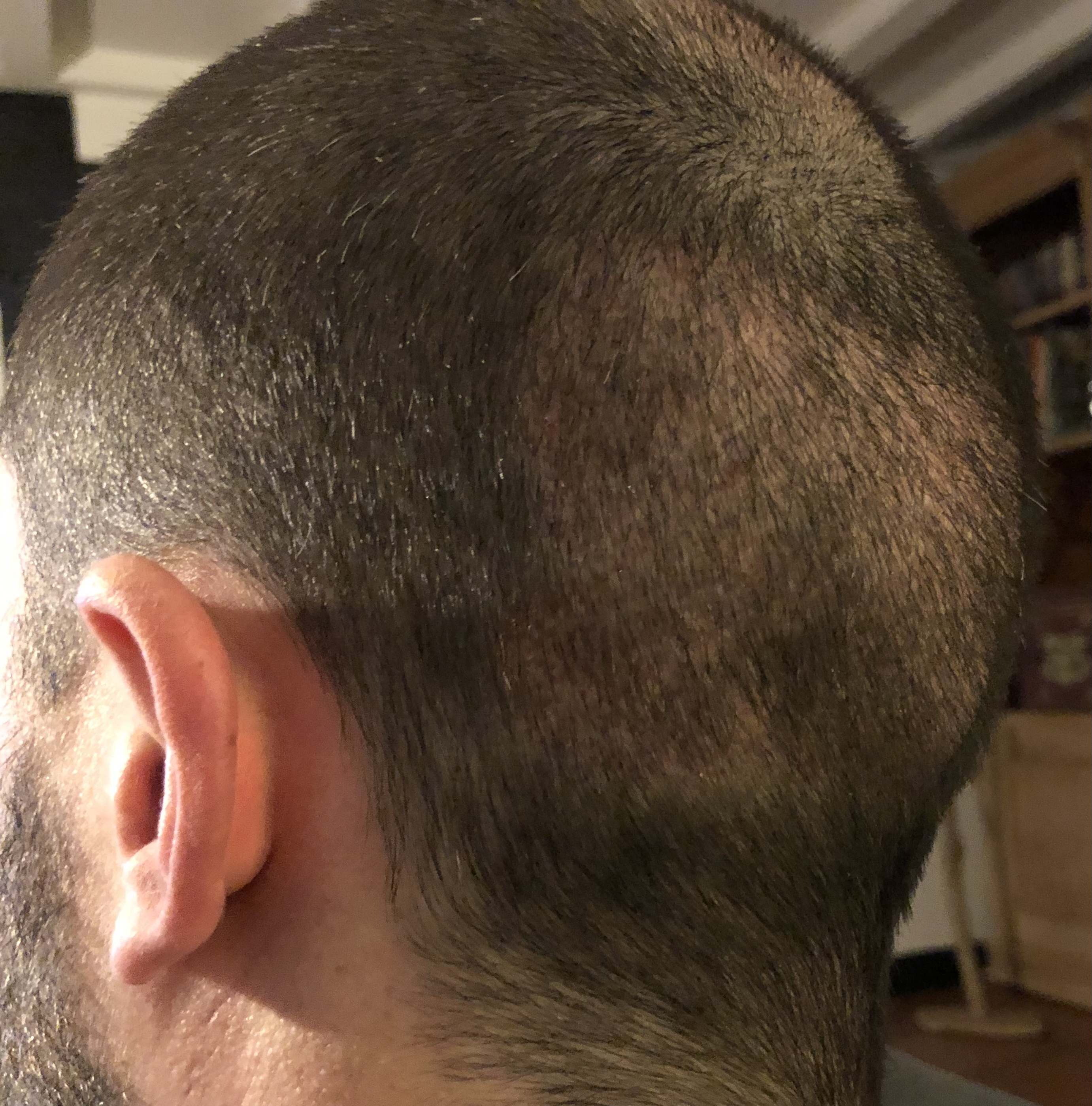 /foren/transplant/index.php/fa/60637/0/