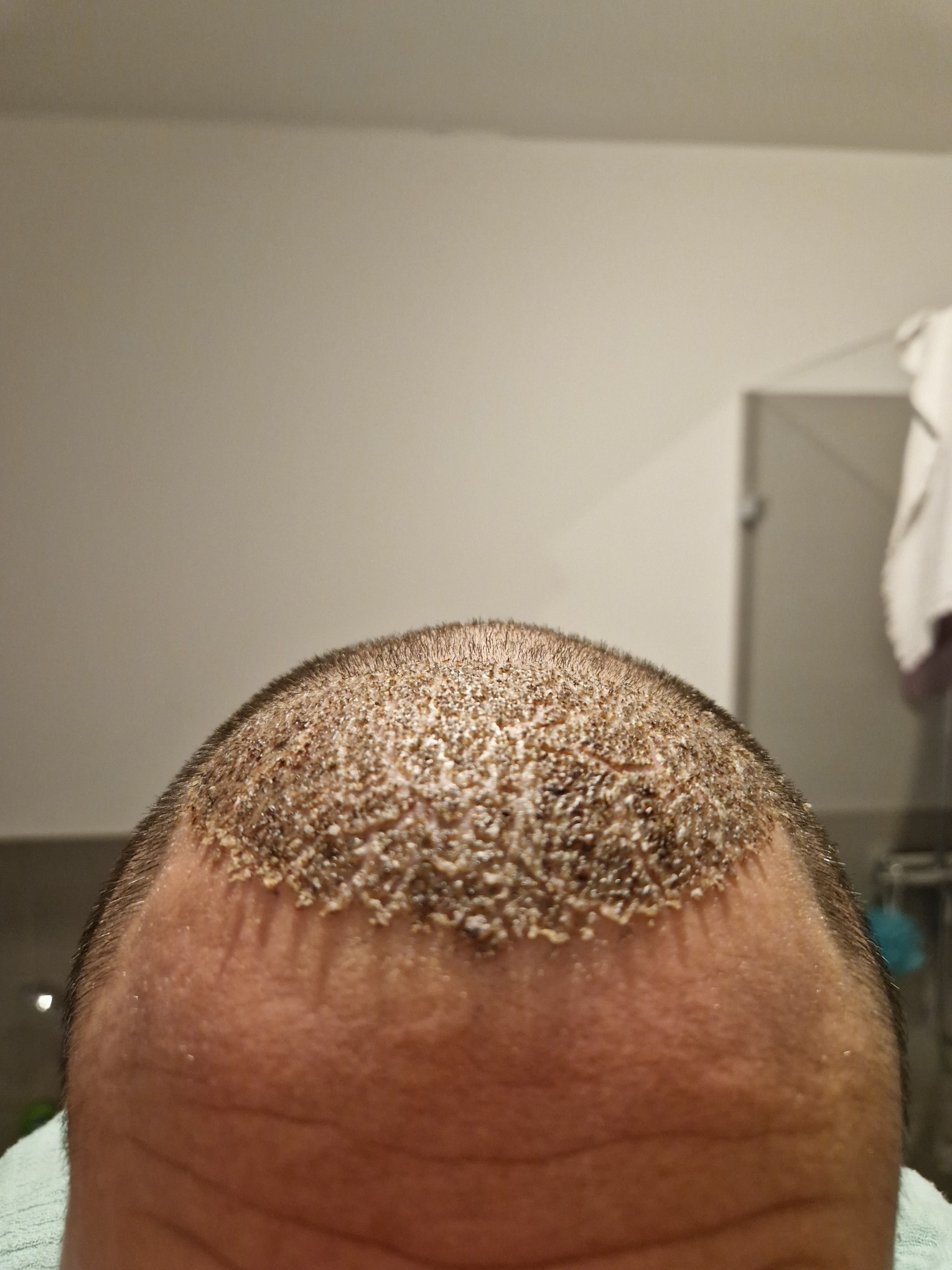 /foren/transplant/index.php/fa/60659/0/