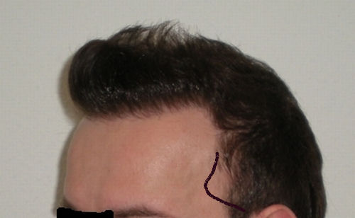 index.php/fa/6076/0/