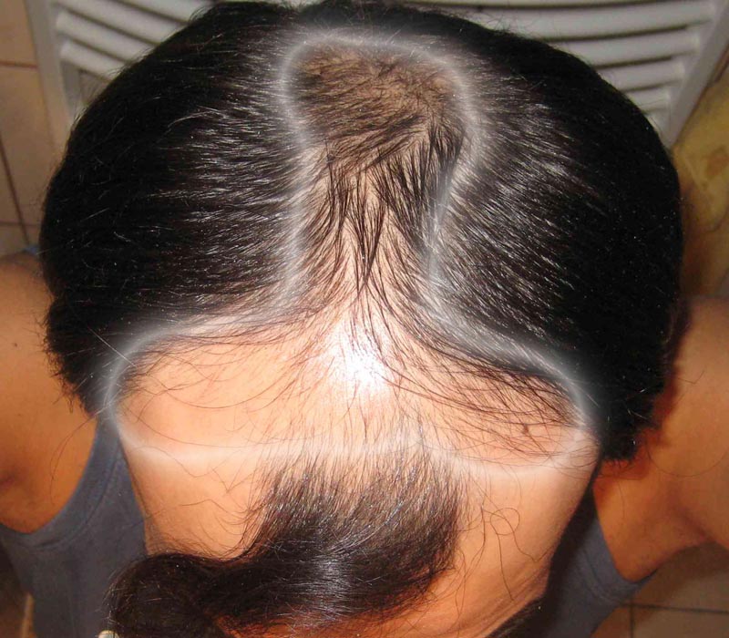 index.php/fa/6094/0/