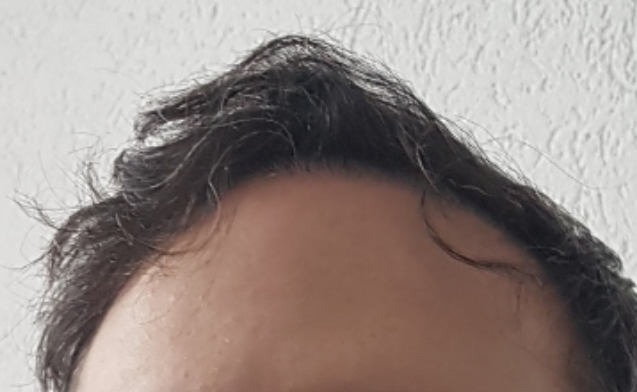 /foren/transplant/index.php/fa/60966/0/