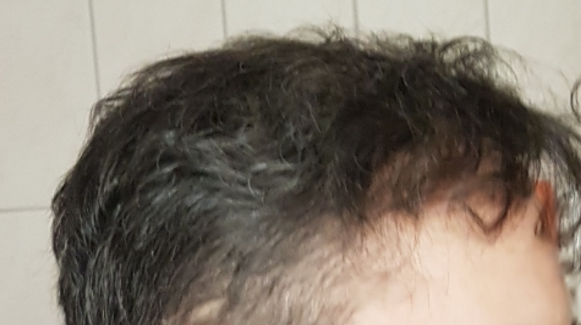 /foren/transplant/index.php/fa/60967/0/