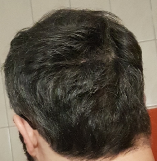 /foren/transplant/index.php/fa/60968/0/