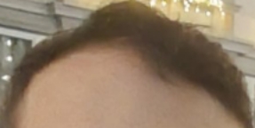 /foren/transplant/index.php/fa/60969/0/