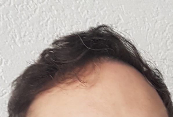 /foren/transplant/index.php/fa/60970/0/