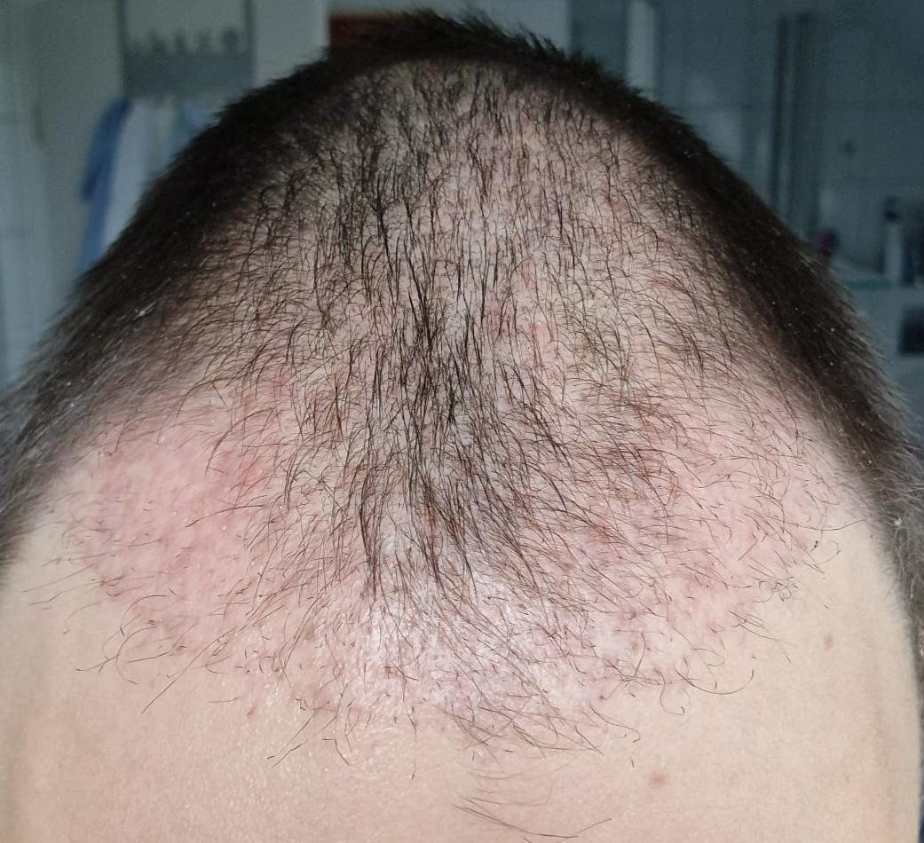 /foren/transplant/index.php/fa/60986/0/