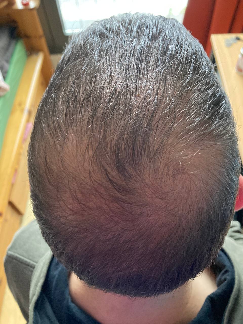 /foren/transplant/index.php/fa/61063/0/