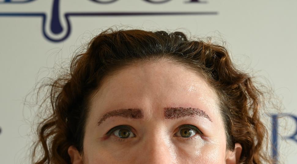 /foren/transplant/index.php/fa/61403/0/