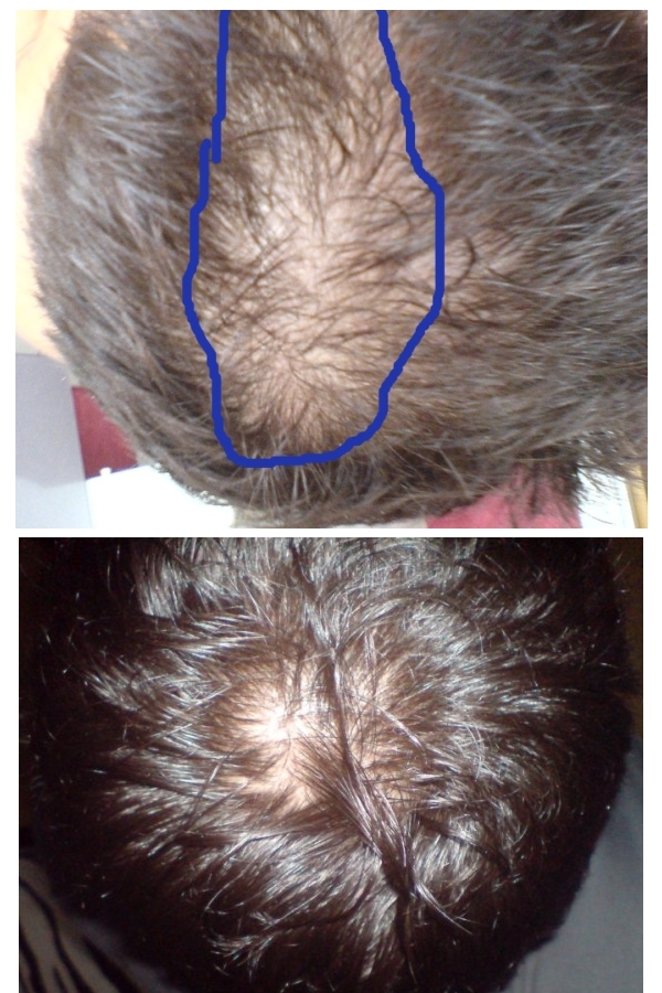 index.php/fa/6143/0/