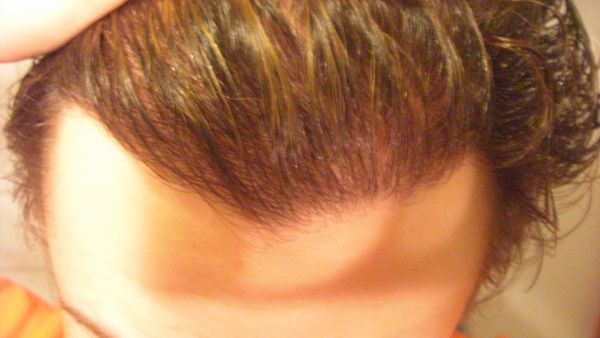 index.php/fa/6151/0/