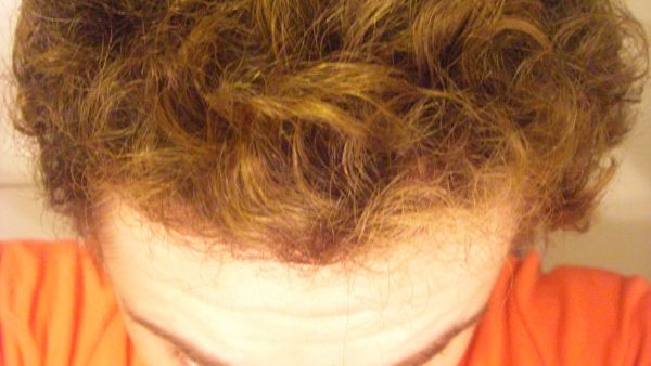 index.php/fa/6154/0/