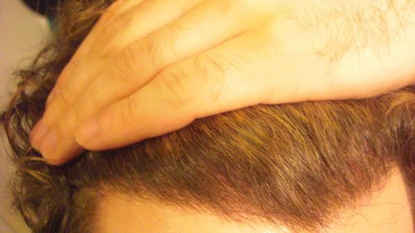 index.php/fa/6156/0/