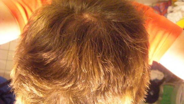 index.php/fa/6162/0/