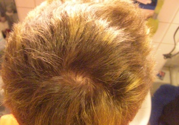 index.php/fa/6163/0/