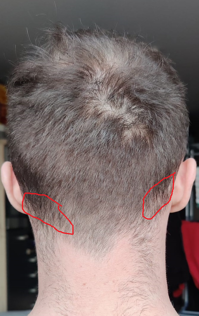 /foren/transplant/index.php/fa/61676/0/