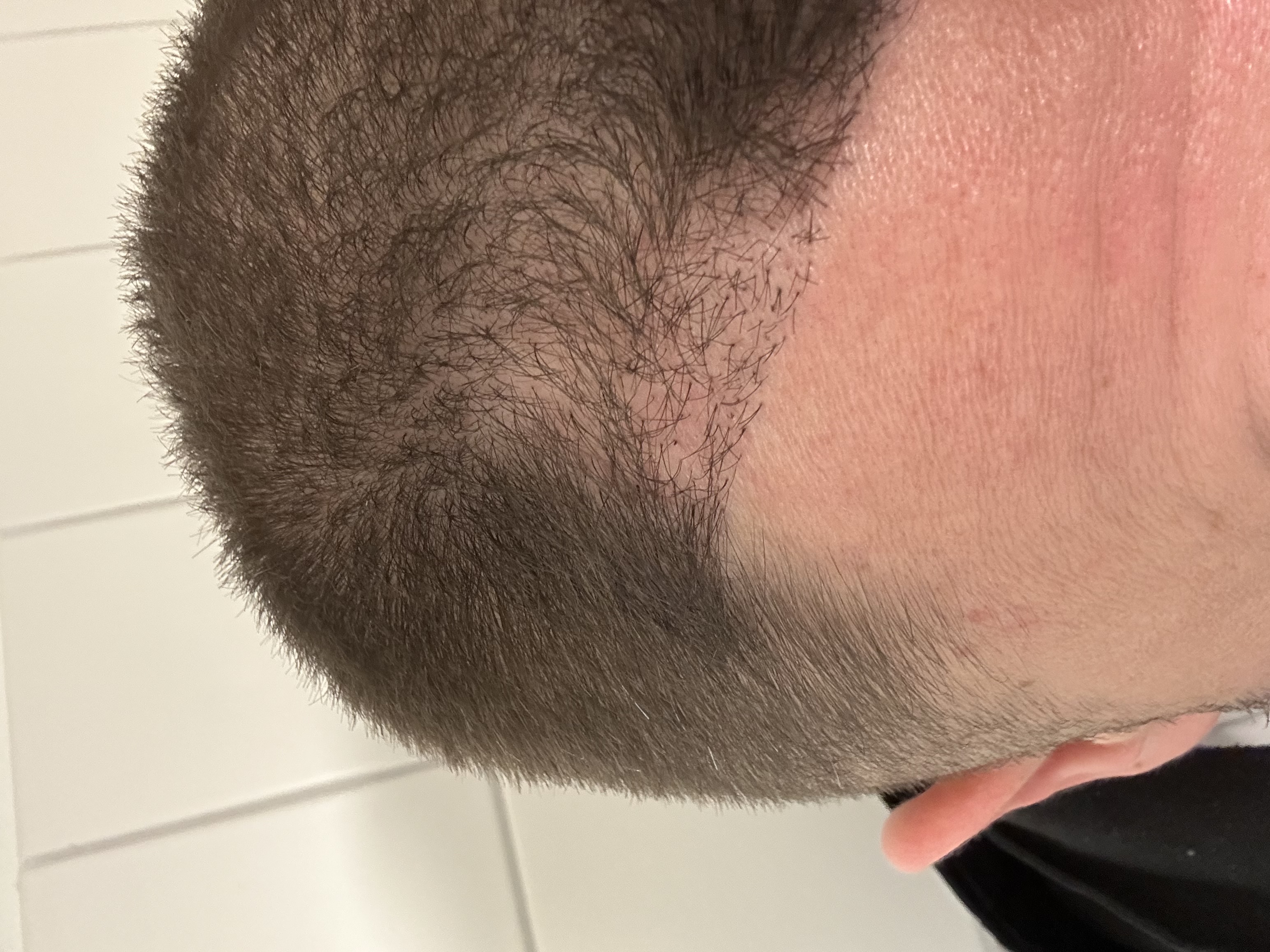 /foren/transplant/index.php/fa/61684/0/