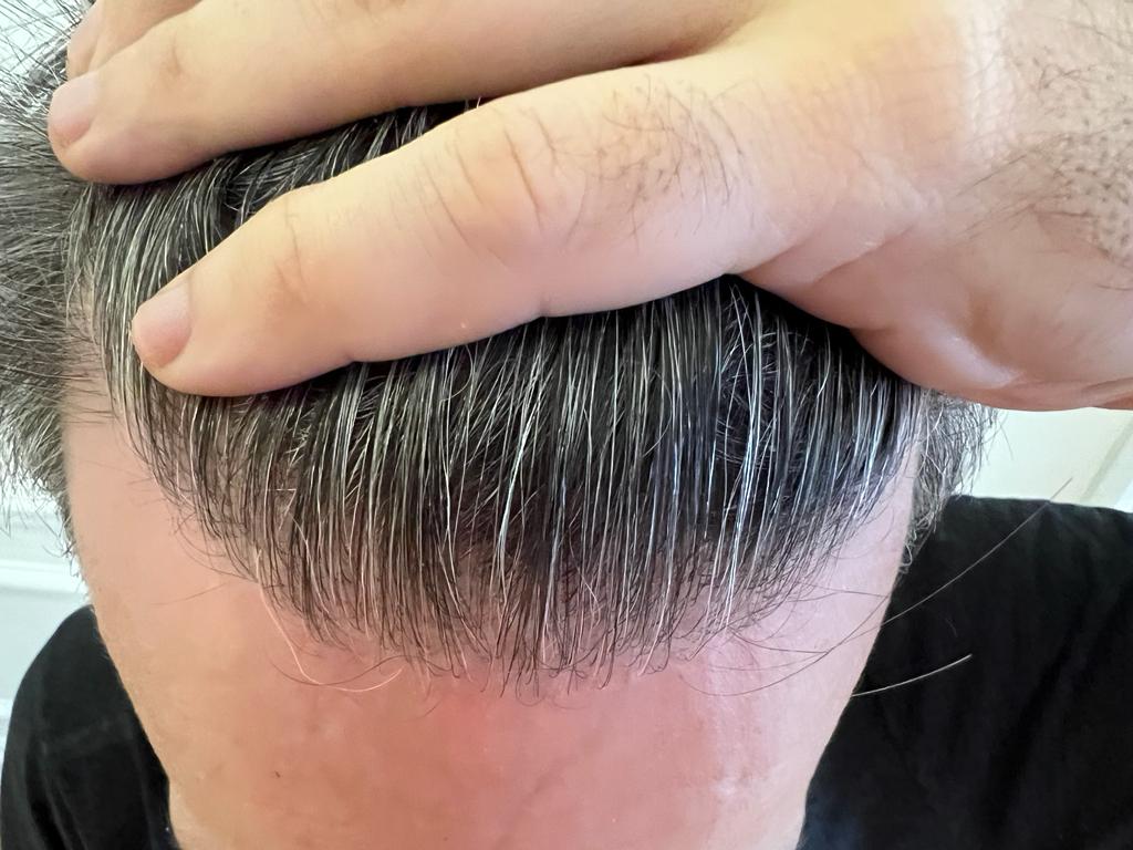 /foren/transplant/index.php/fa/61746/0/