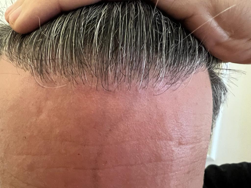 /foren/transplant/index.php/fa/61747/0/