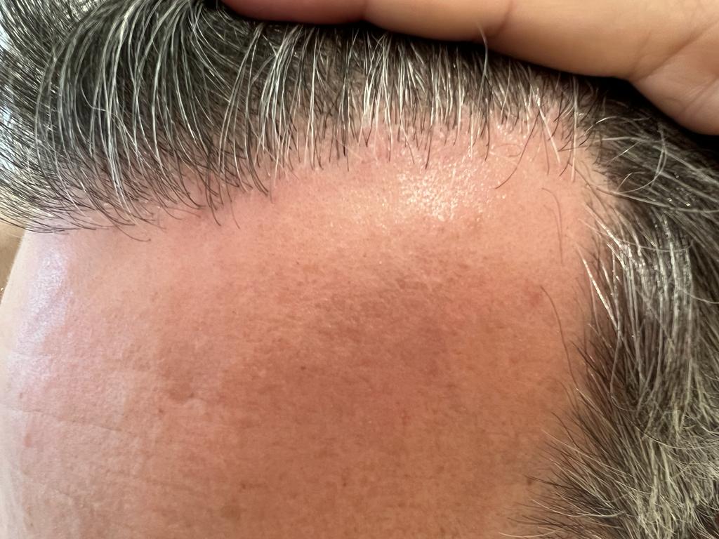 /foren/transplant/index.php/fa/61748/0/