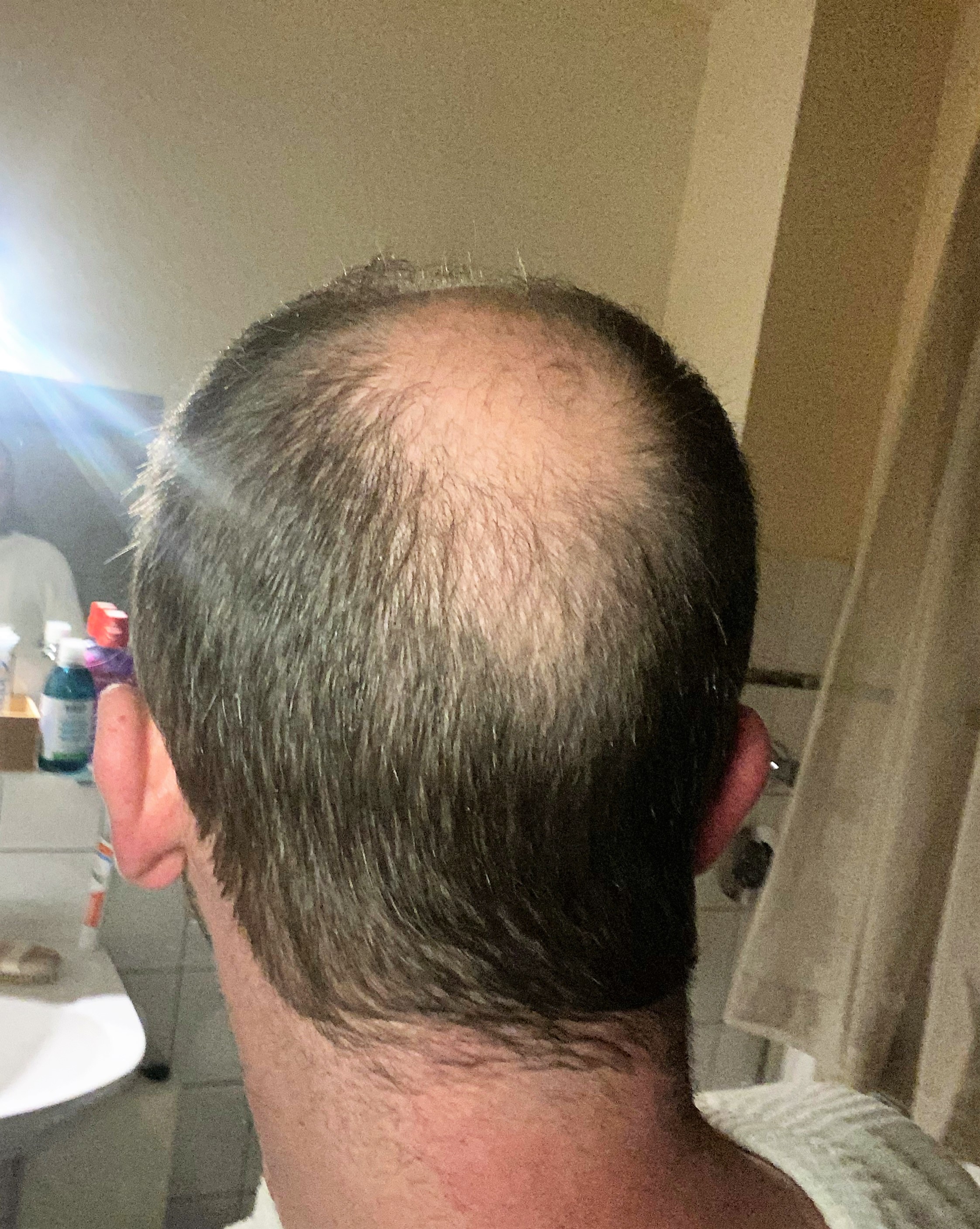 /foren/transplant/index.php/fa/61753/0/