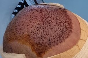 /foren/transplant/index.php/fa/61764/0/