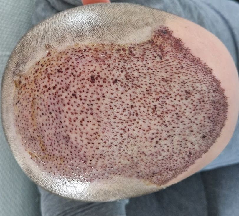 /foren/transplant/index.php/fa/61765/0/