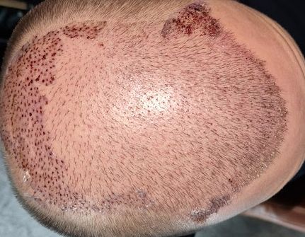 /foren/transplant/index.php/fa/61766/0/