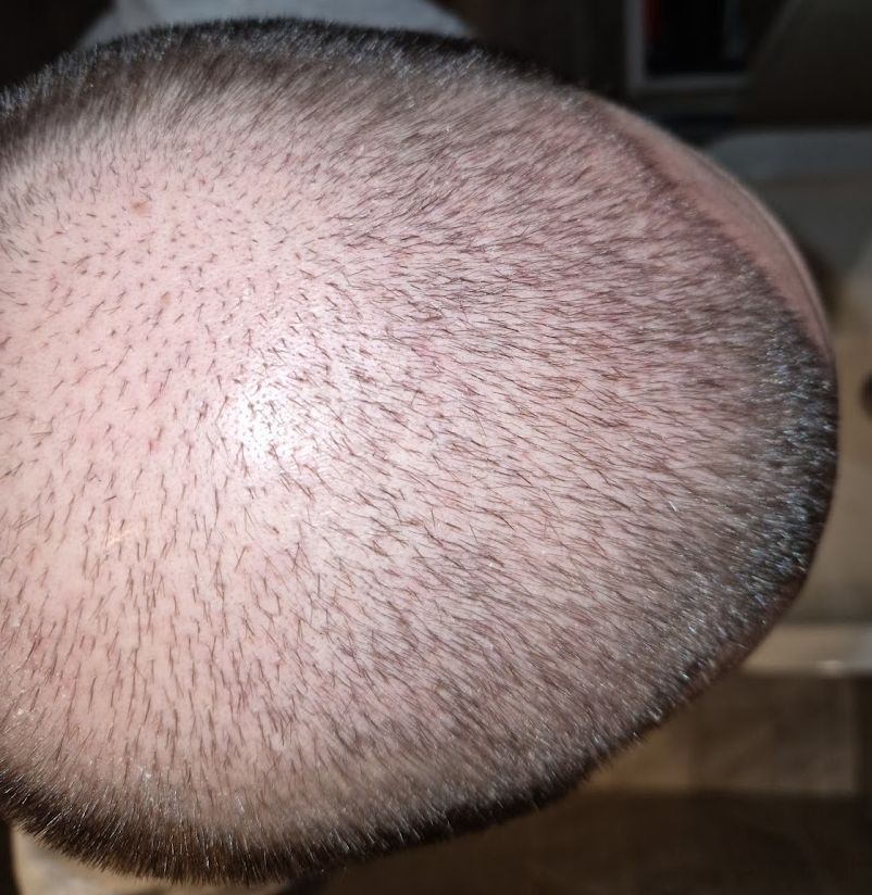 /foren/transplant/index.php/fa/61767/0/