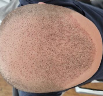 /foren/transplant/index.php/fa/61770/0/