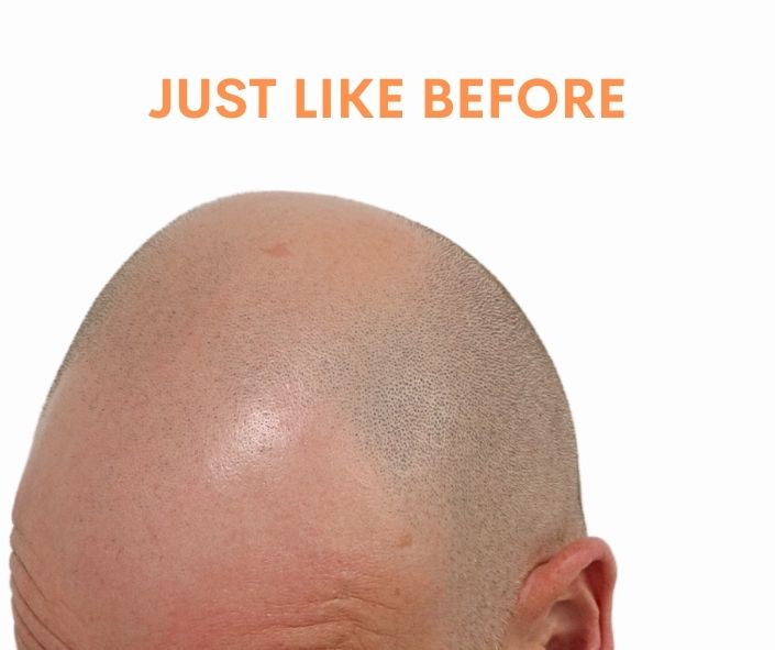 /foren/transplant/index.php/fa/61905/0/