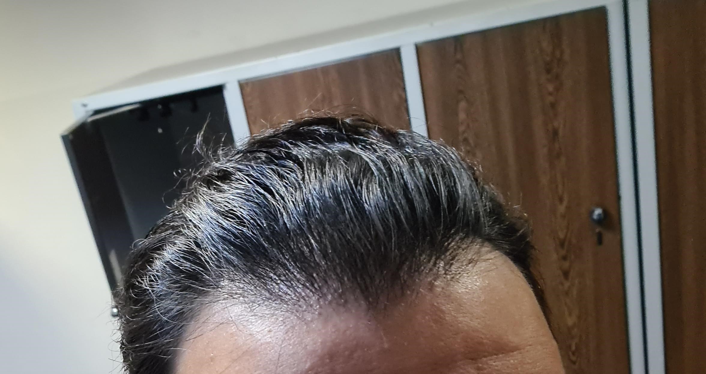 /foren/transplant/index.php/fa/61927/0/