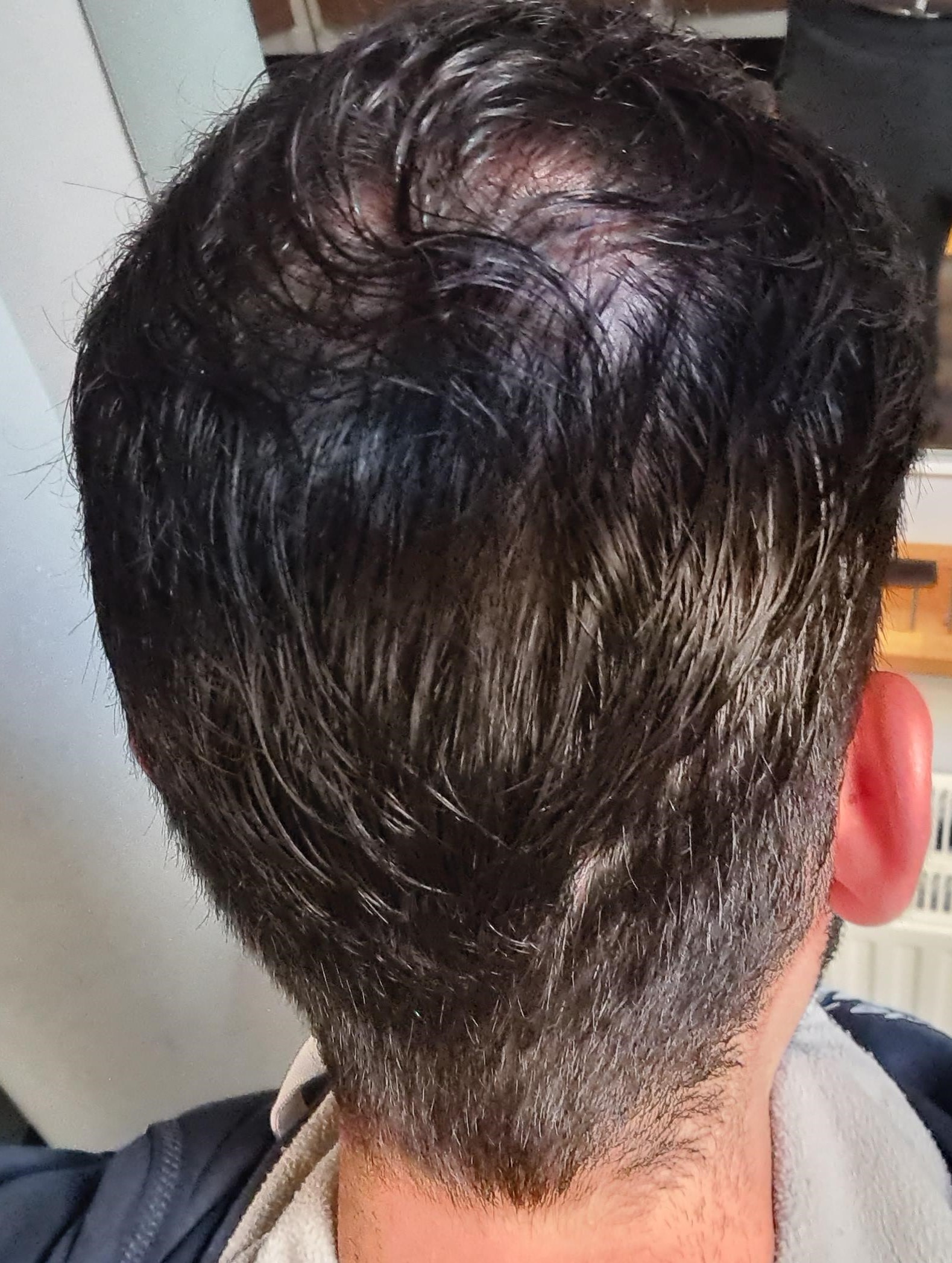 /foren/transplant/index.php/fa/61928/0/