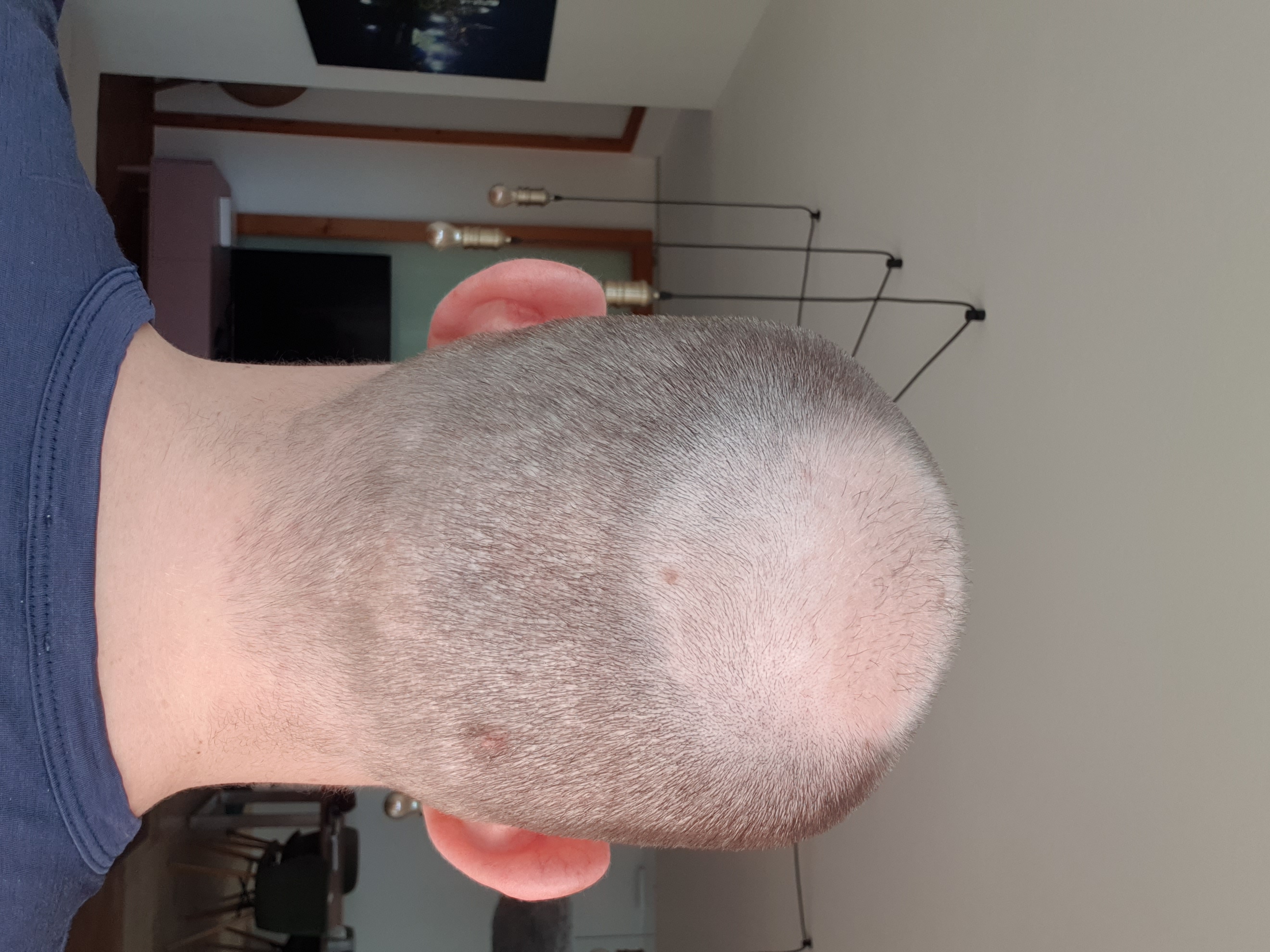 /foren/transplant/index.php/fa/61951/0/